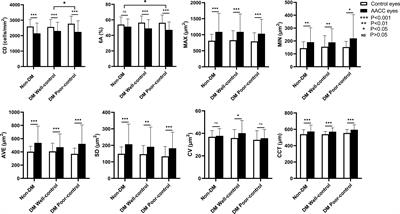 The effects of acute angle closure crisis on corneal endothelial cells in patients with type 2 diabetes mellitus